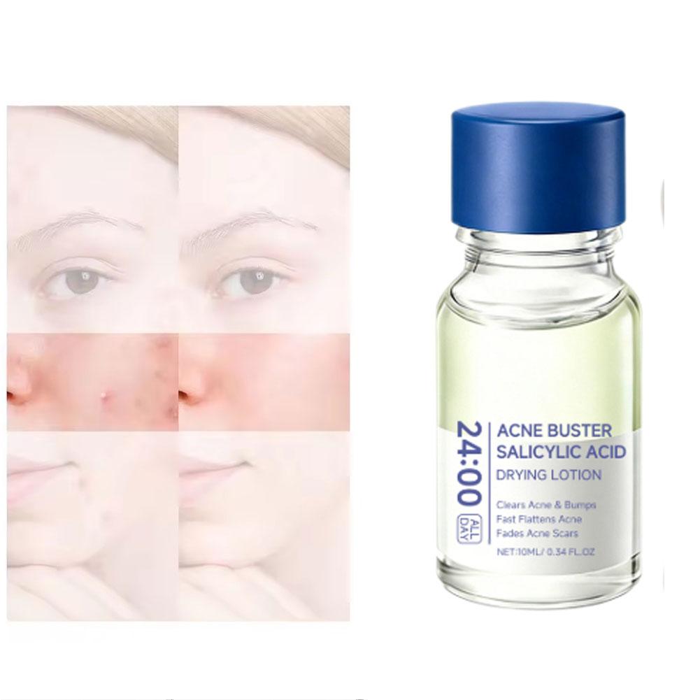 Salicylic Acid Essence Treatme - Tranexamic Acid Serum review and price