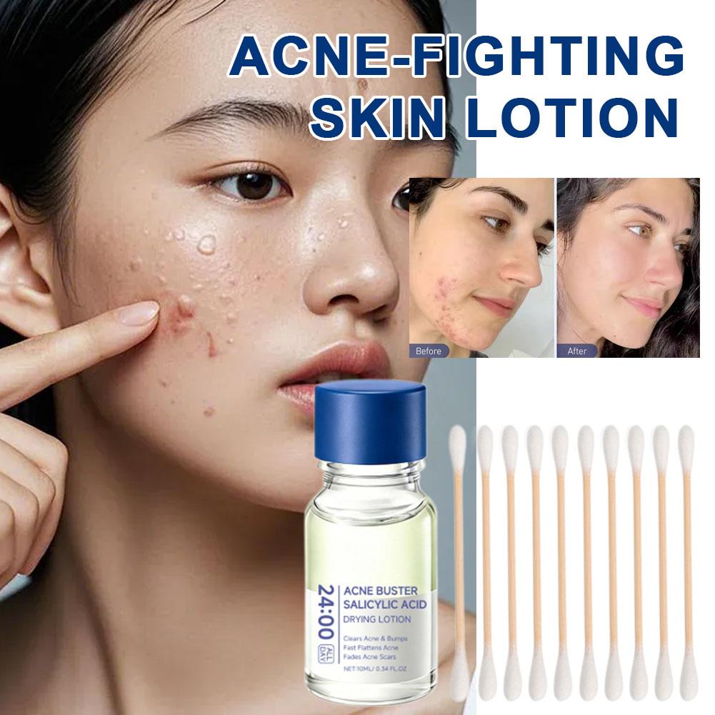 Salicylic Acid Essence Treatme - Tranexamic Acid Serum review and price