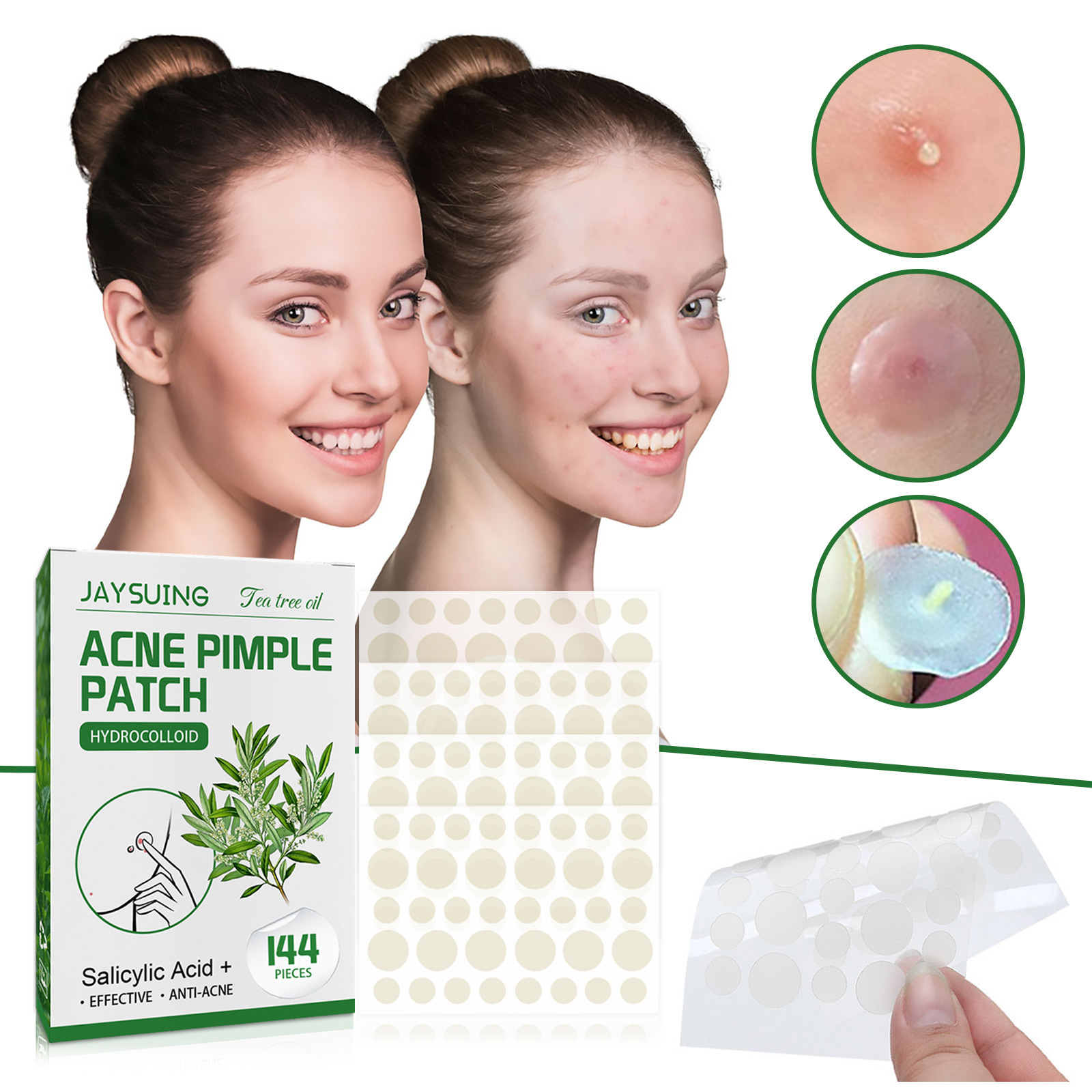 Hydrocolloid Acne Patches - Ab - Skincare The Originote review and price