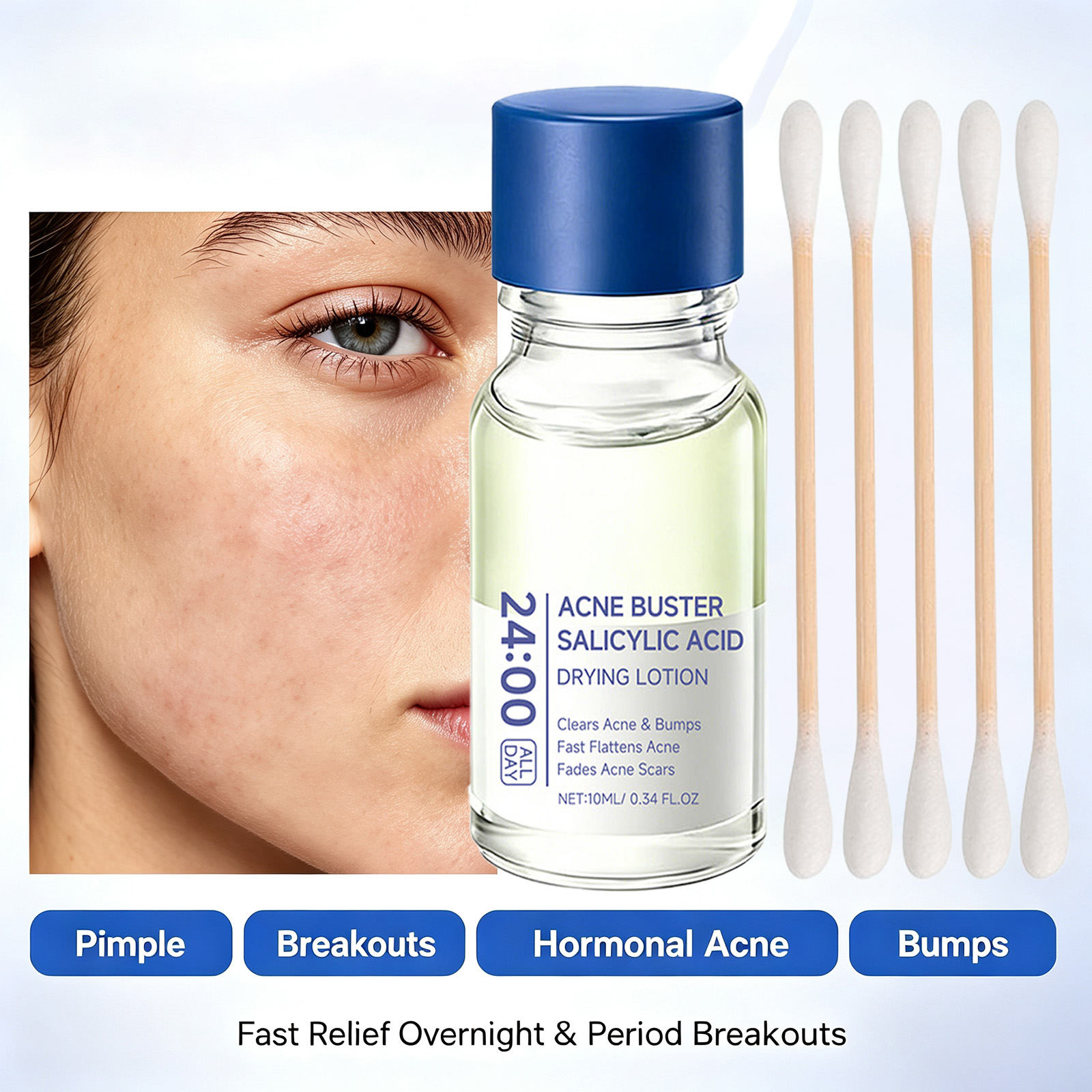 Salicylic Acid Acne Treatment  - Tranexamic Acid Serum review and price
