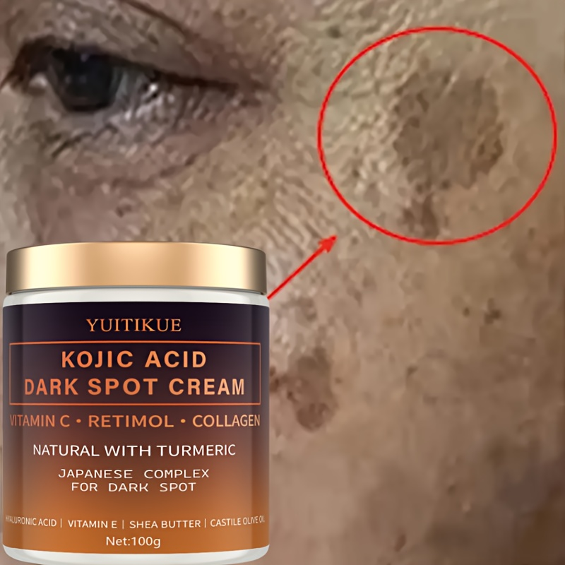 Arbutin fading cream, Vitamin  - Skincare Vitamin C review and price